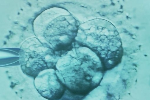 embryo transfer blog featured image