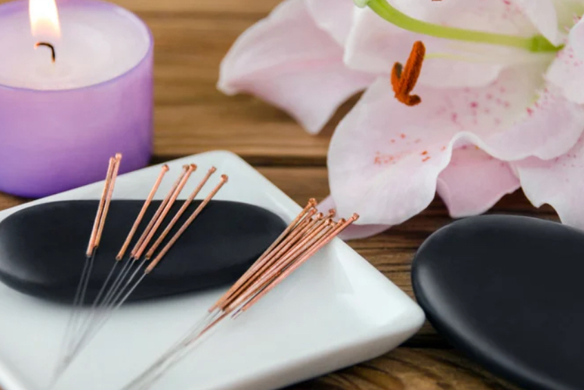 fertility acupuncture blog featured image