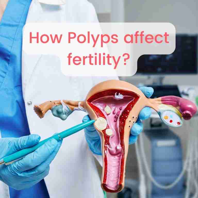 How Polyps affect fertility