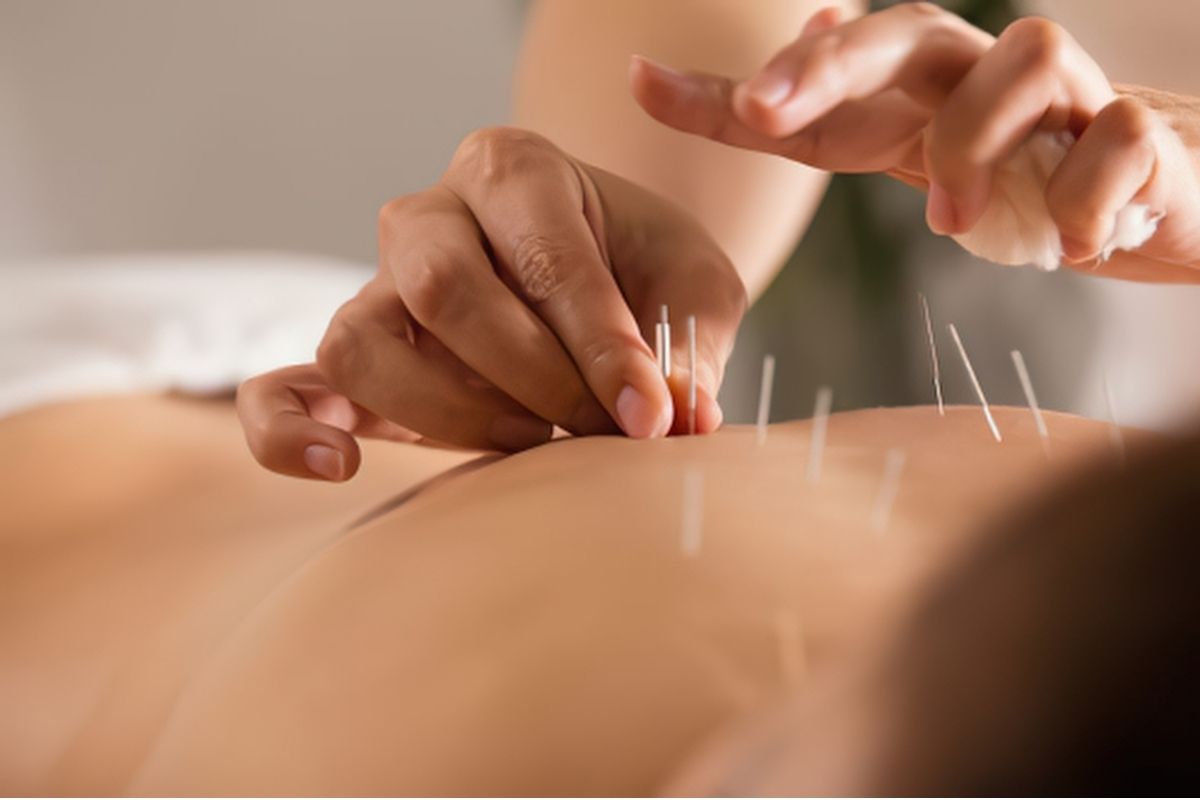 acupuncture for relaxation