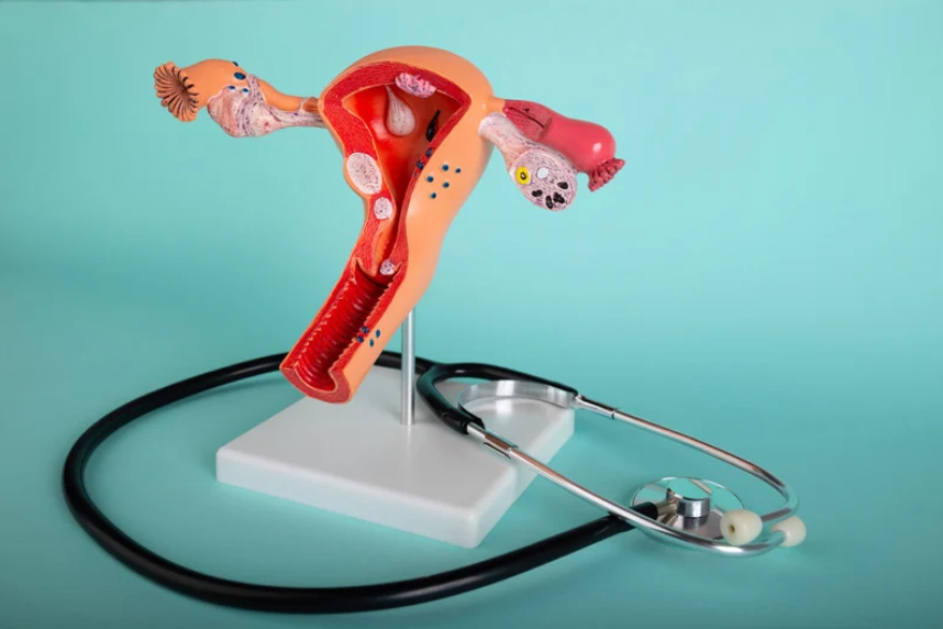 endometriosis diagnosis blog featured image